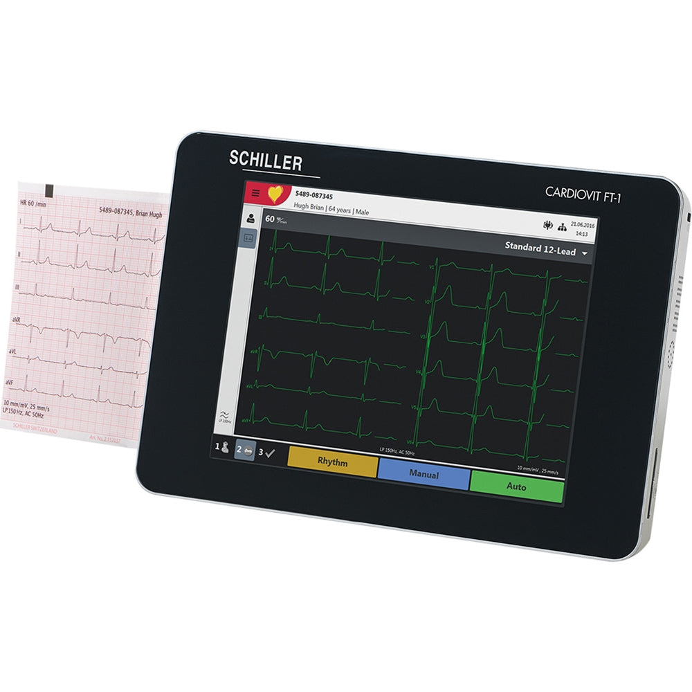 Electrocardiogram (EKG)