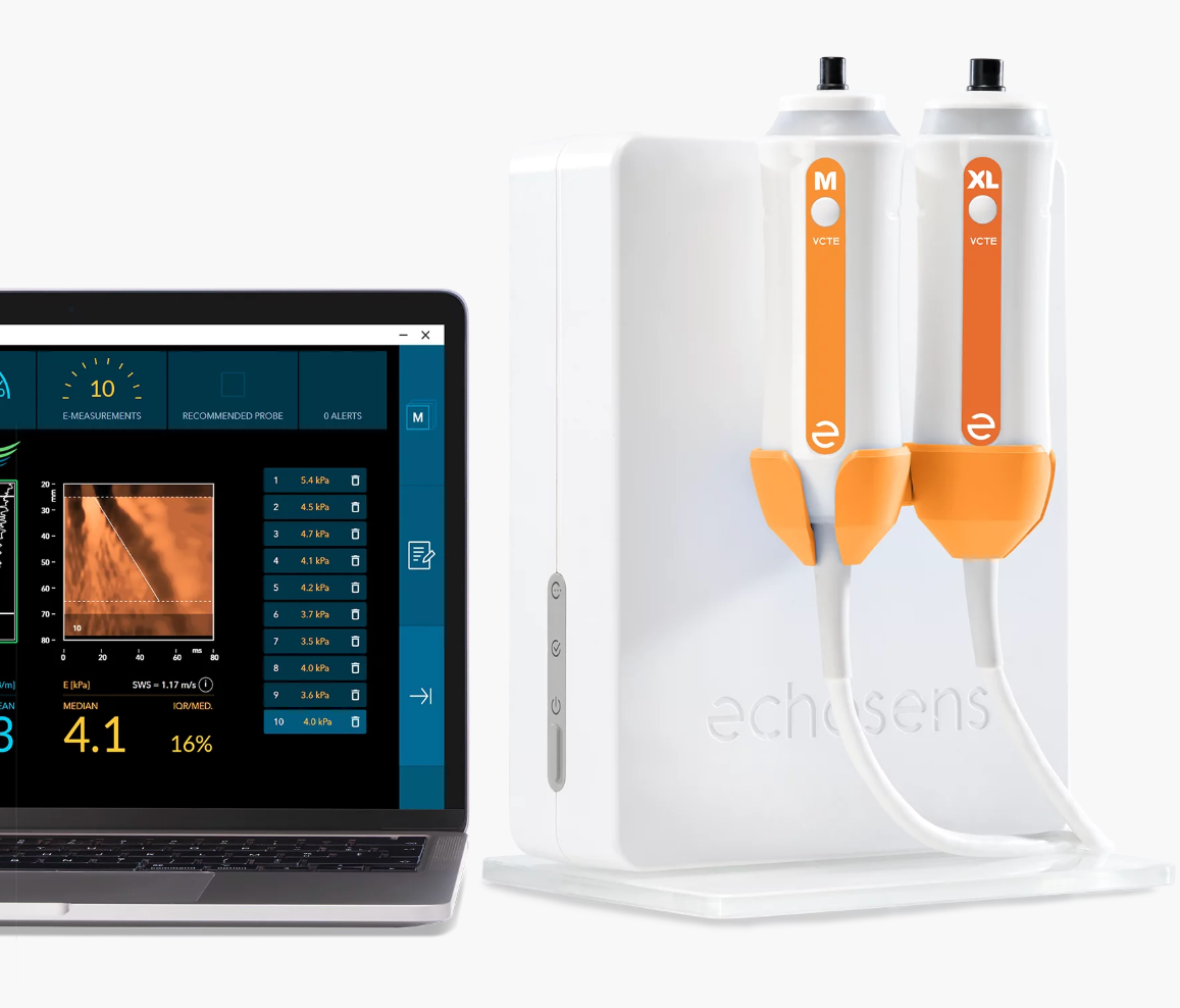 Fibroscan (Liver Scan)